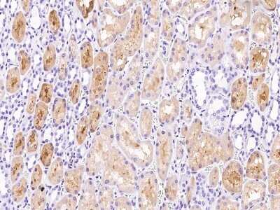 Immunohistochemistry-Paraffin: mu Crystallin Antibody [NBP2-99358] - Immunochemical staining of human mu Crystallin in human brain with rabbit polyclonal antibody at 1:1000 dilution, formalin-fixed paraffin embedded sections.