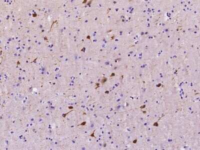 Immunohistochemistry-Paraffin: mu Crystallin Antibody [NBP2-99358] - Immunochemical staining of human mu Crystallin in human kidney with rabbit polyclonal antibody at 1:1000 dilution, formalin-fixed paraffin embedded sections.