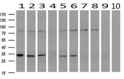 Western Blot: mu Crystallin Antibody (OTI1G7) [NBP2-02829] - analysis of extracts (10ug) from 10 Human tissue by using anti-CRYM monoclonal antibody at 1:200 (1: Testis; 2: Omentum; 3: Uterus; 4: Breast; 5: Brain; 6: Liver; 7: Ovary; 8: Thyroid gland; 9: colon;10: spleen).