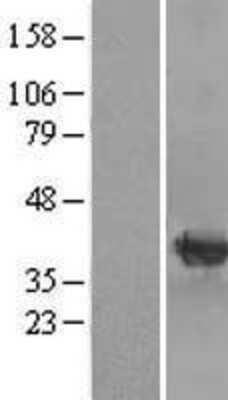 Western Blot: mu Crystallin Overexpression Lysate (Adult Normal) [NBL1-09503] Left-Empty vector transfected control cell lysate (HEK293 cell lysate); Right -Over-expression Lysate for mu Crystallin.