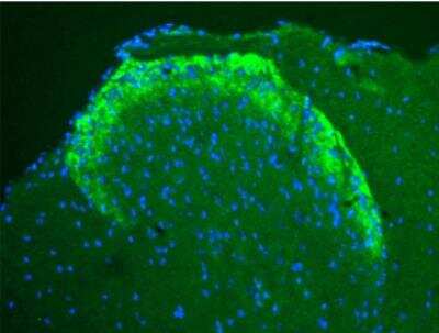 Immunocytochemistry/Immunofluorescence: mu Opioid R/OPMR1 Antibody [NB100-1618] - Staining of Mouse Dorsal Horn, using a 1:50 dilution of 1:50.
