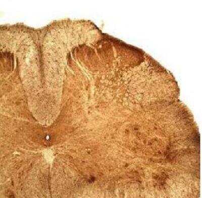 Immunohistochemistry: mu Opioid R/OPRM1 Antibody [NB100-1618] -  Rat Dorsal Horn. Courtesy of Dr. Louis Gendron, University of Sherbrooke