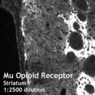 Immunohistochemistry: mu Opioid R/OPMR1 Antibody [NB100-1620] -  Striatum