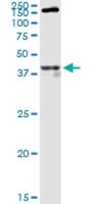Western Blot: mu Opioid R/OPMR1 Antibody [H00004988-A01] - Analysis of OPRM1 expression in rat muscle.