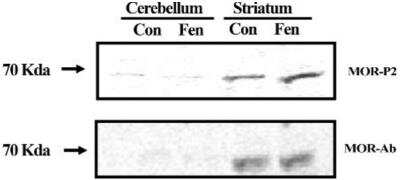 Western Blot: mu Opioid R/OPMR1 Antibody [NB100-1618] - Analysis of isolated mouse brain striatum and cerebellum for the non-phospho-MOR antibody or the MOR-P2 antibody. The samples from cerebellum demonstrate a lack of IR for both the non-phospho-MOR antibody and MOR-P2 antibody further showing the selectivity of these antibodies. The images are each representative of four independent experiments. Dilution 1:1000.