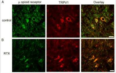 Immunocytochemistry/Immunofluorescence: mu Opioid R/OPRM1 Antibody [NB100-1620] - Labeling showing the presence of a subpopulation of spinal lamina II neurons that contained both u opioid receptor (green) and TRPV1 (red) immunoreactivity in a vehicle (A)- and a RTX (B)-treated rats. Scale bar, 20 um. More information found: J Neurophysiol 95: 3086-3096, 2006. First published February 8, 2006; doi:10.1152/jn.01343.2005 0022-3077