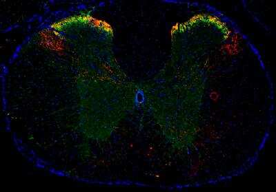 Immunohistochemistry-Frozen: mu Opioid R/OPRM1 Antibody [NB100-1620] - Opioid R/OPRM1 (green) and Substance P (red) were detected in frozen mouse spinal cord and DRG tissue by fluorescent multiplex IHC.  Mu Opioid R/OPRM1 Antibody (NB100-1620), used at 1:100, and Substance P Antibody (NB100-65219), used at 1:50, were applied to the tissue and simultaneously incubated at 4C overnight. Anti-Rabbit Alexa Fluor(R) 488-conjugated secondary antibody and anti-Rat NL557-conjugated secondary antibody (NL013) were applied to the tissue, and simultaneously incubated at room temperature, protected from light for 1 hour. Coverslips were applied to the tissue slide along with mounting media containing DAPI (blue) and imaged using a 4X objective lens.