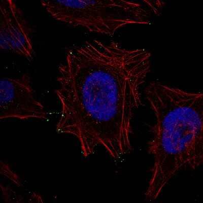 Immunocytochemistry/Immunofluorescence: myosin X Antibody (CL8994) [NBP2-88926] - Staining of HeLa cells using the Anti-MYO10 monoclonal antibody, showing specific staining at the tips of filopodia in green. Actin- and nuclear probes are visualized in red and blue, respectively (where available).