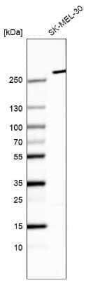 Western Blot: myosin X Antibody (CL9025) [NBP2-88927] - Analysis in human cell line SK-MEL-30.