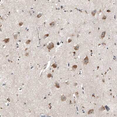 Immunohistochemistry-Paraffin: myosin X Antibody (CL9032) [NBP2-88928] - Staining of human cerebral cortex shows strong cytoplasmic positivity in neurons.