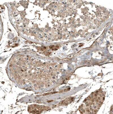 Immunohistochemistry-Paraffin: myosin X Antibody (CL9032) [NBP2-88928] - Staining of human testis shows strong cytoplasmic positivity in Leydig cells.