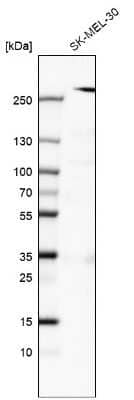 Western Blot: myosin X Antibody (CL9032) [NBP2-88928] - Analysis in human cell line SK-MEL-30.