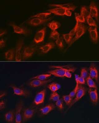 Immunocytochemistry/Immunofluorescence: myosin X Antibody [NBP2-94085] - Immunofluorescence analysis of U2OS cells using myosin X antibody (NBP2-94085) at dilution of 1:350. Blue: DAPI for nuclear staining.