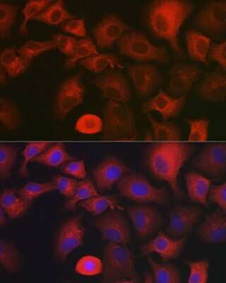 Immunocytochemistry/Immunofluorescence: myosin X Antibody [NBP2-94085] - Immunofluorescence analysis of A-549 cells using myosin X antibody (NBP2-94085) at dilution of 1:350. Blue: DAPI for nuclear staining.