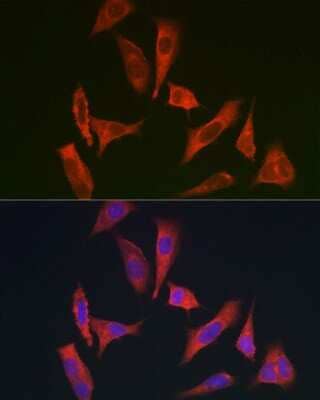 Immunocytochemistry/Immunofluorescence: myosin X Antibody [NBP2-94085] - Immunofluorescence analysis of HeLa cells using myosin X antibody (NBP2-94085) at dilution of 1:350. Blue: DAPI for nuclear staining.