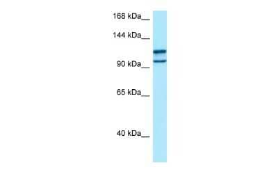 Western Blot: myosin X Antibody [NBP2-85352] - WB Suggested Anti-MYO10 Antibody. Titration: 1.0 ug/ml. Positive Control: 293T Whole Cell