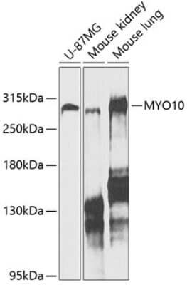 Western Blot: myosin X Antibody [NBP2-94085] - Analysis of extracts of various cell lines, using myosin X .Exposure time: 20s.