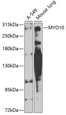 Western Blot: myosin X Antibody [NBP2-94658] - Analysis of extracts of various cell lines, using myosin X .Exposure time: 90s.