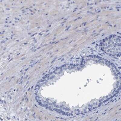 Immunohistochemistry-Paraffin: myozenin 3 Antibody [NBP1-90616] - Staining of human prostate shows low expression as expected.