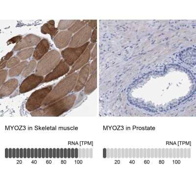 Immunohistochemistry-Paraffin: myozenin 3 Antibody [NBP1-90616] - Staining in human skeletal muscle and prostate tissues using anti-MYOZ3 antibody. Corresponding MYOZ3 RNA-seq data are presented for the same tissues.