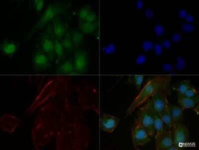 Immunocytochemistry/Immunofluorescence: n-Myc Antibody (NMYC-1) - Azide and BSA Free [NBP2-80882] - The n-Myc (NMYC-1) antibody was tested in NTERA2 cells at a 1:50 dilution against Dylight 488 (Green). Actin and nuclei were counterstained against Phalloidin 568 (Red) and DAPI (Blue), respectively. Image from the standard format of this antibody.