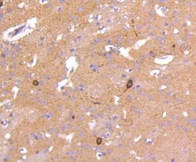 Immunohistochemistry-Paraffin: nNOS Antibody (ST520) [NBP2-67532] - Analysis of paraffin-embedded mouse brain tissue using anti-nNOS antibody. Counter stained with hematoxylin.