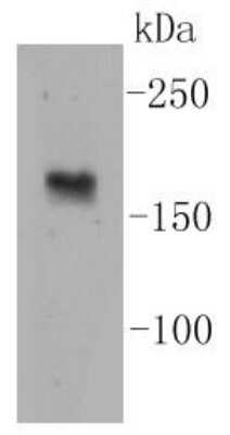 Western Blot: nNOS Antibody (ST520) [NBP2-67532] - Analysis of nNOS on mouse heart lysates using anti-nNOS antibody at 1/1,000 dilution.