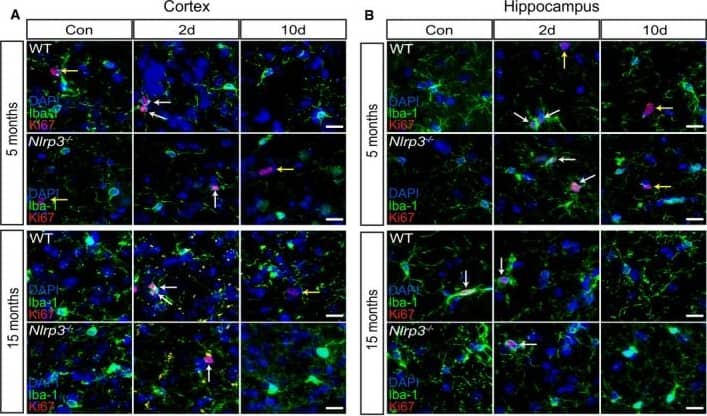 Immunocytochemistry/ Immunofluorescence: AIF-1/Iba1 Antibody [NB100-1028] - Microglia proliferate in non‐APP mice upon peripheral immune challengeA, BIba‐1, Ki67, & DAPI staining in the cortex & hippocampus of wild‐type & Nlrp3−/− (5 & 15 months old). Microglia proliferate upon LPS injection (white arrows). Non‐microglia cells proliferation was observed as well (yellow arrows). Scale bar: 20 μm.CQuantification of microglial proliferation in cortex (left panel) & hippocampus (right panel) (mean of 5 ± SEM; two‐way ANOVA followed by Tukey's post hoc test, *P < 0.05, **P < 0.01, ***P < 0.001). Image collected & cropped by CiteAb from the following publication (//pubmed.ncbi.nlm.nih.gov/31359456), licensed under a CC-BY license. Not internally tested by Novus Biologicals.