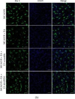 Immunocytochemistry/ Immunofluorescence: AIF-1/Iba1 Antibody [NB100-1028] - ABIN1 knockdown impairs the antineuroinflammatory effect of EA. (a) The concentrations of TNF-alpha , IL-1 beta , & MCP-1 in the peri-infarct cortex were detected using ELISAs at 24 h after reperfusion (n = 5 rats per group). (b) Microglial morphology was observed by conducting immunofluorescence staining for Iba-1 (green) in the peri-infarct cortex at 24 h after reperfusion (n = 3 rats per group). Scale bar = 50 μm. (c & d) Quantification of microglial endpoints/cell & process length/cell (∗∗P < 0.01 compared to the MCAO/R group; #P < 0.05 & ##P < 0.01 compared to the MCAO/R + EA group). Image collected & cropped by CiteAb from the following publication (//pubmed.ncbi.nlm.nih.gov/33110436), licensed under a CC-BY license. Not internally tested by Novus Biologicals.