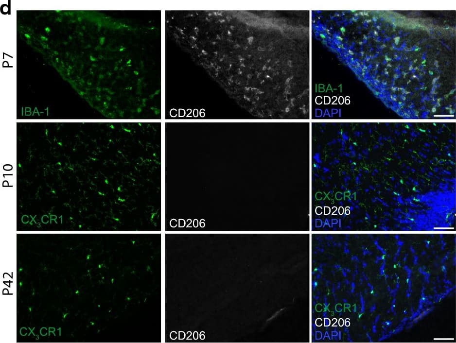 Immunocytochemistry/ Immunofluorescence: AIF-1/Iba1 Antibody [NB100-1028] - a Heatmap of regulated genes related to phagocytosis in the corpus callosum (CC), cerebellum (Cb) & cortex (Cx) at different ages [postnatal day (P)7, 10, 42]. b Heatmap of known priming genes in the CC, Cb & Cx at P7, P10 & P42. Asterisks highlighting genes confirmed on protein level; Representative immunofluorescence pictures of wildtype mice depicting SPP1 [red (c, e)], CLEC7a [white (c, e)] & CD206 [white (d)] expression in IBA-1+ microglia (green) in the CC (c, d), Cx (e left) & Cb (e right) at P7, P10 & P42. Scale bar 50 µm; blue = DAPI; arrow indicating IBA-1+/SPP1+ cell in Cb; N = 3–4 mice per timepoint Image collected & cropped by CiteAb from the following publication (//pubmed.ncbi.nlm.nih.gov/31262353), licensed under a CC-BY license. Not internally tested by Novus Biologicals.