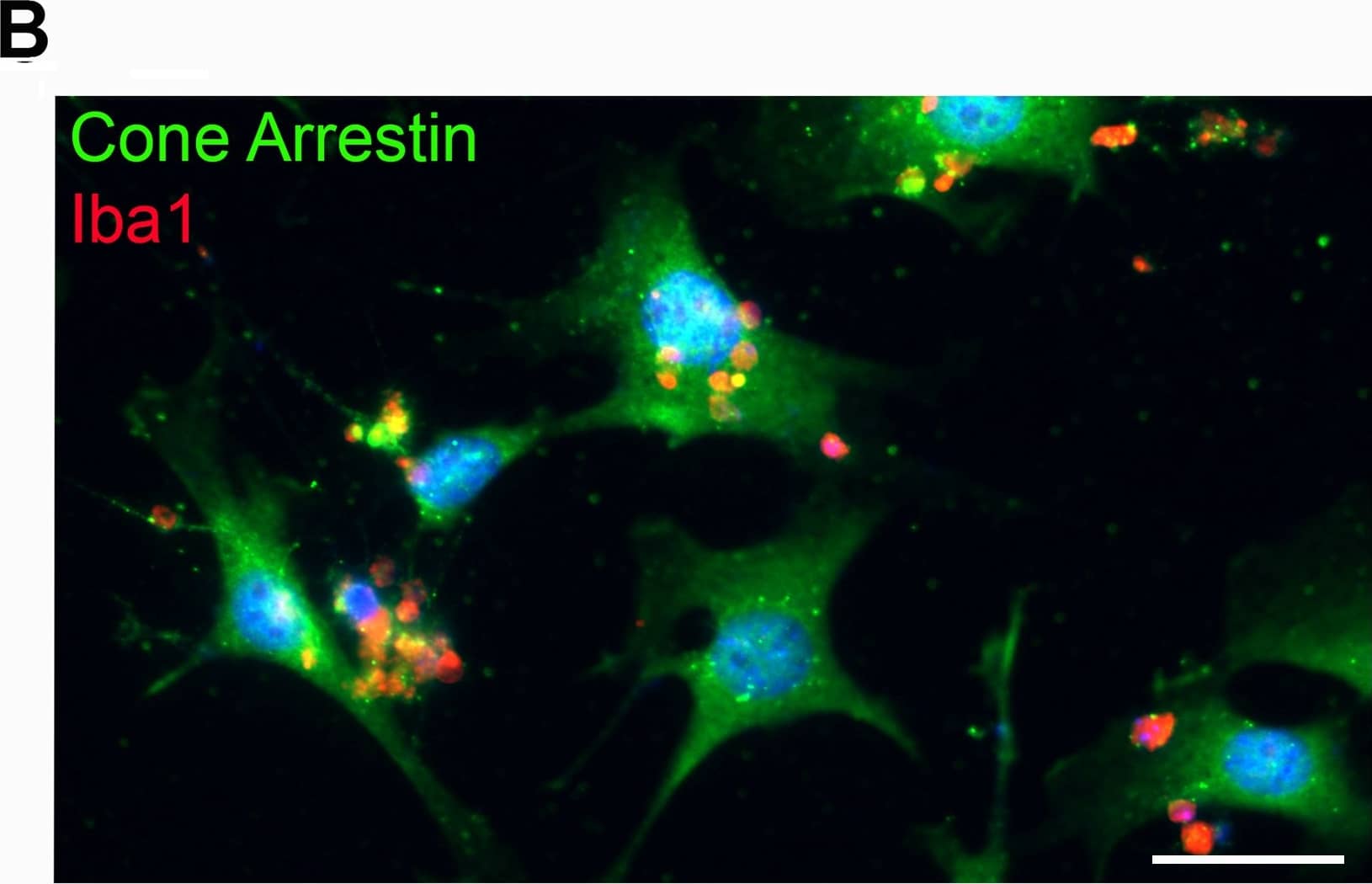 Immunocytochemistry/ Immunofluorescence: AIF-1/Iba1 Antibody [NB100-1028] - Norgestrel significantly abrogates rd10 microglial-induced 661W cell death. (B) Representative fluorescent microscopic image of primary rd10 microglial cells (Iba1; red) in culture with 661W cells (Cone arrestin; green). Hoechst (blue) staining reveals cell nuclei. Scale bar 30μm. Image collected & cropped by CiteAb from the following publication (//dx.plos.org/10.1371/journal.pone.0165197), licensed under a CC-BY license. Not internally tested by Novus Biologicals.