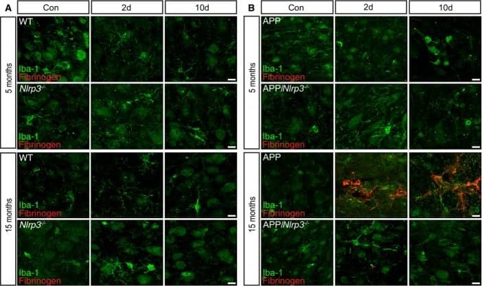 Immunocytochemistry/ Immunofluorescence: AIF-1/Iba1 Antibody [NB100-1028] - Blood–brain barrier is compromised in old APP mice upon LPS injectionIba‐1 (green) & fibrinogen (red) staining in cortex of 5 & 15 months old of wild‐type & Nlrp3−/− mice. Scale bar: 10 μm.Iba‐1 (green) & fibrinogen (red) staining in cortex of 5 & 15 months old of APP & APP/Nlrp3−/− mice. Scale bar: 10 μm.Fibrinogen integrated density in wild‐type & Nlrp3−/− mice (left panel) & APP & APP/Nlrp3−/− mice (right panel) (mean of 5 ± SEM; two‐way ANOVA followed by Tukey's post hoc test, ***P < 0.001). Image collected & cropped by CiteAb from the following publication (//pubmed.ncbi.nlm.nih.gov/31359456), licensed under a CC-BY license. Not internally tested by Novus Biologicals.