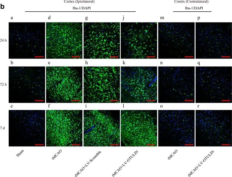 Immunocytochemistry/ Immunofluorescence: AIF-1/Iba1 Antibody [NB100-1028] - OTULIN overexpression reduced the number of Iba-1+ microglial cells in the cortical ischemic penumbra in focal cerebral ischemia/reperfusion rats. A Representative images of Iba-1+ microglial cells that were morphologically classified into three types; scale bar = 10 μm. B Iba-1+ microglial cells in the ischemic penumbra & contralateral cortex of each group were detected by confocal immunofluorescence at 24 h, 72 h, & 7 days; scale bar = 75 μm. C The histogram represents the quantitative analysis of mean Iba-1 immunofluorescence intensity in each group (n = 6). Data are presented as the means ± SEMs; ###P < 0.001 versus the tMCAO group; &&&P < 0.001 versus the tMCAO+LV-Scramble group Image collected & cropped by CiteAb from the following publication (//pubmed.ncbi.nlm.nih.gov/29544517), licensed under a CC-BY license. Not internally tested by Novus Biologicals.