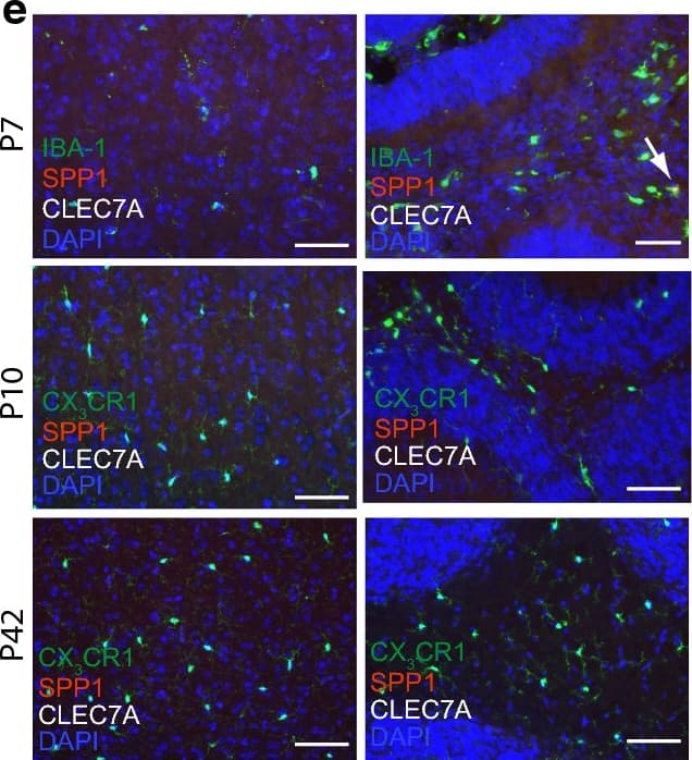 Immunocytochemistry/ Immunofluorescence: AIF-1/Iba1 Antibody [NB100-1028] - a Heatmap of regulated genes related to phagocytosis in the corpus callosum (CC), cerebellum (Cb) & cortex (Cx) at different ages [postnatal day (P)7, 10, 42]. b Heatmap of known priming genes in the CC, Cb & Cx at P7, P10 & P42. Asterisks highlighting genes confirmed on protein level; Representative immunofluorescence pictures of wildtype mice depicting SPP1 [red (c, e)], CLEC7a [white (c, e)] & CD206 [white (d)] expression in IBA-1+ microglia (green) in the CC (c, d), Cx (e left) & Cb (e right) at P7, P10 & P42. Scale bar 50 µm; blue = DAPI; arrow indicating IBA-1+/SPP1+ cell in Cb; N = 3–4 mice per timepoint Image collected & cropped by CiteAb from the following publication (//pubmed.ncbi.nlm.nih.gov/31262353), licensed under a CC-BY license. Not internally tested by Novus Biologicals.