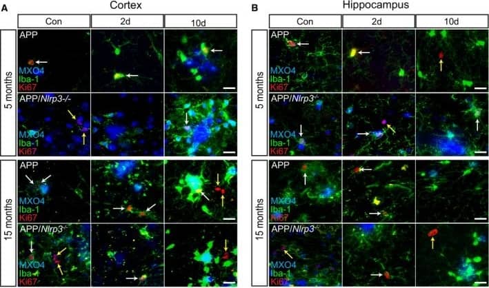 Immunocytochemistry/ Immunofluorescence: AIF-1/Iba1 Antibody [NB100-1028] - Microglia proliferate in APP/PS1 mice upon peripheral immune challengeA, BIba‐1, Ki67, & MXO4 staining in the cortex & hippocampus of APP & APP/Nlrp3−/− (5 & 15 months old). Microglia proliferate upon LPS injection (white arrows). Non‐microglia cells proliferation was observed as well (yellow arrows). Scale bar: 20 μm.CQuantification of microglial proliferation in cortex (left panel) & hippocampus (right panel) (mean of 5 ± SEM; two‐way ANOVA followed by Tukey's post hoc test, *P < 0.05, **P < 0.01, ***P < 0.001). Image collected & cropped by CiteAb from the following publication (//pubmed.ncbi.nlm.nih.gov/31359456), licensed under a CC-BY license. Not internally tested by Novus Biologicals.