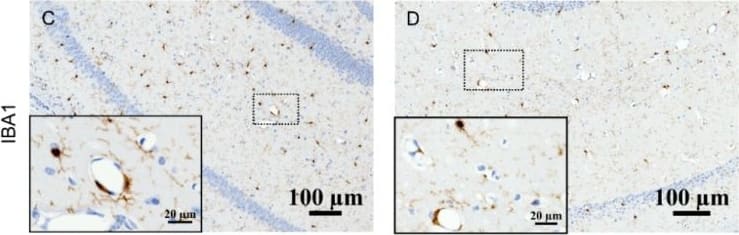 Immunohistochemistry: AIF-1/Iba1 Antibody [NB100-1028] - Microglia infiltrate 3×Tg-AD mice brains in a perivascular fashion. Representative hippocampal bright-field × 40 micrographs with × 100 insets. Perivascular infiltration with CD-68+ cells of control (A) & norvaline-treated mice (B) hippocampi. Iba1+ microglia in control (C) & norvaline-treated (D) mice. Measurement of the CD-68 immunopositive surface area (E) & stain intensity (F) with ZEN 2.5 revealed a significant effect of the treatment. (G) The relative intensity of perivascular Iba1+ microglia. Student’s unpaired t-test, n = 20, * p < 0.05. Image collected & cropped by CiteAb from the following publication (//pubmed.ncbi.nlm.nih.gov/31540372), licensed under a CC-BY license. Not internally tested by Novus Biologicals.
