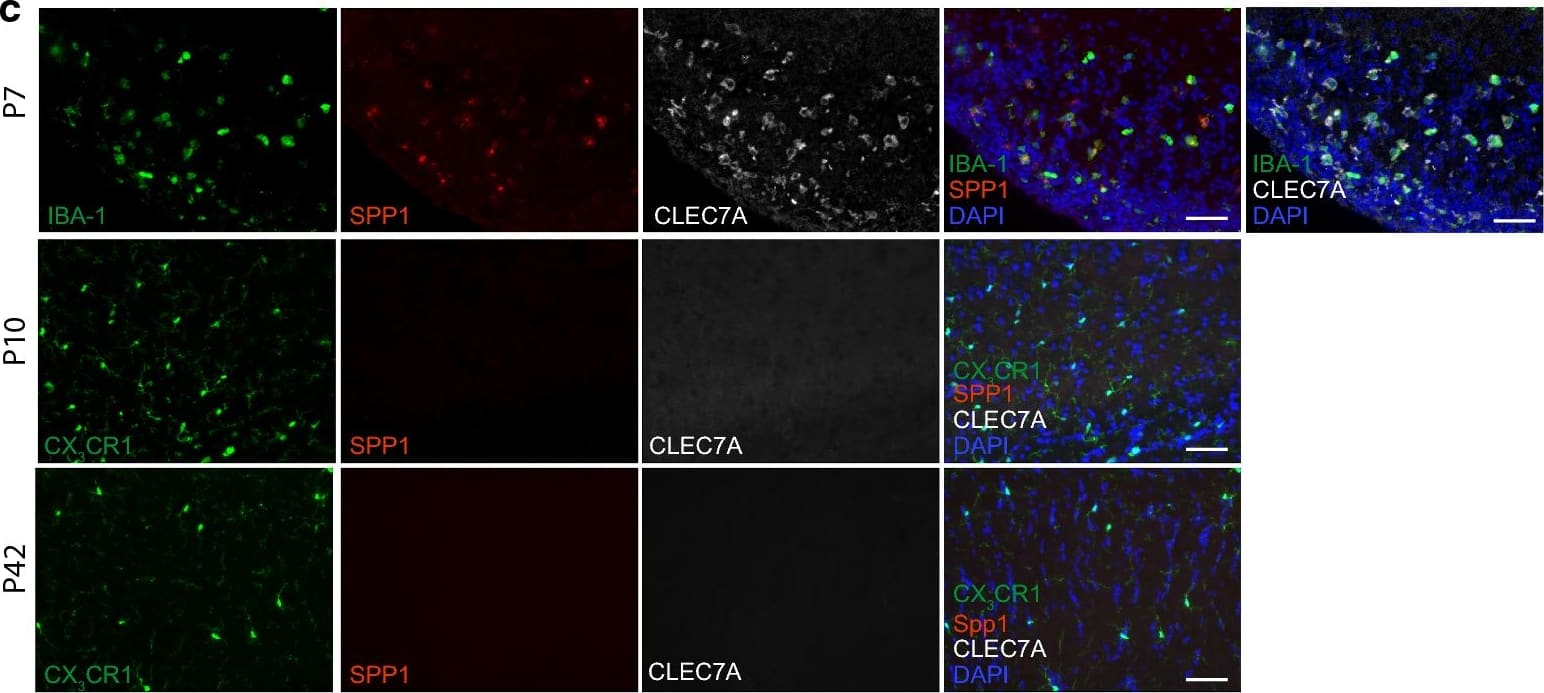 Immunocytochemistry/ Immunofluorescence: AIF-1/Iba1 Antibody [NB100-1028] - a Heatmap of regulated genes related to phagocytosis in the corpus callosum (CC), cerebellum (Cb) & cortex (Cx) at different ages [postnatal day (P)7, 10, 42]. b Heatmap of known priming genes in the CC, Cb & Cx at P7, P10 & P42. Asterisks highlighting genes confirmed on protein level; Representative immunofluorescence pictures of wildtype mice depicting SPP1 [red (c, e)], CLEC7a [white (c, e)] & CD206 [white (d)] expression in IBA-1+ microglia (green) in the CC (c, d), Cx (e left) & Cb (e right) at P7, P10 & P42. Scale bar 50 µm; blue = DAPI; arrow indicating IBA-1+/SPP1+ cell in Cb; N = 3–4 mice per timepoint Image collected & cropped by CiteAb from the following publication (//pubmed.ncbi.nlm.nih.gov/31262353), licensed under a CC-BY license. Not internally tested by Novus Biologicals.