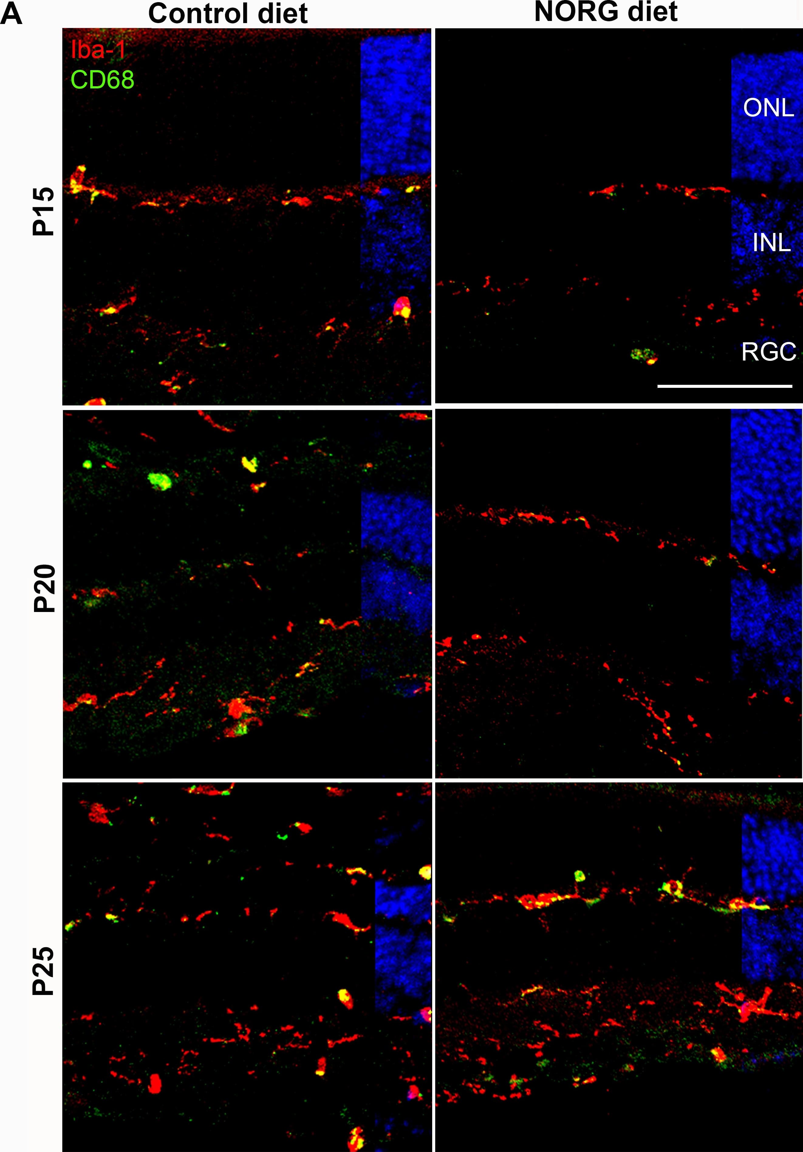 Immunocytochemistry/ Immunofluorescence: AIF-1/Iba1 Antibody [NB100-1028] - Norgestrel dampens pro-inflammatory microglial activity in vivo & decreases DAMP release from photoreceptors.(A) Confocal microscopic images of microglia (Iba1; red) & activated microglia (CD68; green) in the central retina from P15-P25 control & Norgestrel-fed rd10 mice. Less microglia including CD68+ microglia were observed at P15 & P20 in Norgestrel-fed mice. Hoechst (blue) staining reveals the cell layers in the retina. Scale bar 50μm. N = 3 mice per group, n = 8 sections per mouse. (B & C) Quantification of microglial number & CD68-positivity confirmed (B) significantly less microglia at P15 & P20 & (C) significantly less CD68-positivity at P20 with Norgestrel-supplementation. (D) RT-qPCR analysis of mRNA encoding (i) pro-inflammatory (M1) & (ii) & (iii) anti-inflammatory (M2) microglial markers in whole retina from P20-P30 control & Norgestrel-fed rd10 mice. Norgestrel significantly reduced pro-inflammatory & increased anti-inflammatory markers in the retina. Control column represents age-matched rd10 mice on control diet. N = 3 mice per group, n = 3 technical replicates per mouse. (E) RT-qPCR analysis of mRNA encoding danger associated molecular patterns (DAMP), (i) high motility box group 1 (HMGB1) & (ii) interleukin-1 alpha  (IL-1 alpha ) in whole retina from P20-P30 control & Norgestrel-fed rd10 mice. Norgestrel significantly reduced DAMP expression at P20 & P25 in Norgestrel-fed mice. Control column represents age-matched rd10 mice on control diet. N = 3 mice per group, n = 3 technical replicates per mouse. Results are presented as mean ± SEM (t-test, *p<0.05, ***p<0.005, ****p<0.0001). Image collected & cropped by CiteAb from the following publication (//dx.plos.org/10.1371/journal.pone.0165197), licensed under a CC-BY license. Not internally tested by Novus Biologicals.