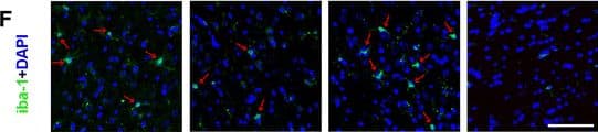 Immunocytochemistry/ Immunofluorescence: AIF-1/Iba1 Antibody [NB100-1028] - A20 silencing prevents the anti-inflammatory effects of EA after focal cerebral ischemia reperfusion. Experiments were performed 24 h after reperfusion in the ischemia/reperfusion cortex, n = 5 per group. a TNF-alpha  & b IL-1 beta  content was measured using ELISA. $$$P < 0.001 vs. the sham group; *P < 0.05, ***P < 0.001 vs. the MCAO group; ###P < 0.001 vs. the MCAO + EA group. The relative mRNA levels of cA1 & dGFAP were measured using RT-qPCR. $$$P < 0.001 vs. the sham group; ***P < 0.001, *P < 0.05 vs. the MCAO group; ###P < 0.001 vs. the MCAO + EA group. The activated morphology of astrocytes & microglia was demonstrated using e GFAP & f Iba-1 immunofluorescence staining (green), respectively. Yellow arrows indicate reactive astrocytes with thick cell bodies, & red arrows indicate hypertrophied activated microglia, noted by their stout, dense appearance with shorter & thicker branched projections. Scale bar = 50 μm Image collected & cropped by CiteAb from the following publication (//jneuroinflammation.biomedcentral.com/articles/10.1186/s12974-016-0731-3), licensed under a CC-BY license. Not internally tested by Novus Biologicals.