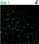 Immunocytochemistry/ Immunofluorescence: AIF-1/Iba1 Antibody [NB100-1028] - The spatial distribution & cell-type location of A20 in the rat brain after I/R. Brain sections of the ischemia/reperfusion cortex of rats in the MCAO + EA group 24 h after reperfusion. Sections were stained with double immunofluorescence labeling (a–d), which showed the upregulated expression of A20 protein (red) in neurons (green, identified using NeuN). e–h Very few of A20-positive (red) astrocytes (green, identified using GFAP) were observed. i–l A20 (red) was barely presented in microglial cells (green, identified using iba-I). Scale bar = 50 μm. 1–3 were the magnified parts from the merged images of d, h, l which more clearly showed the location relationship between A20 & neurons, astrocytes, & microglia, respectively. Scale bar = 25 μm Image collected & cropped by CiteAb from the following publication (//jneuroinflammation.biomedcentral.com/articles/10.1186/s12974-016-0731-3), licensed under a CC-BY license. Not internally tested by Novus Biologicals.