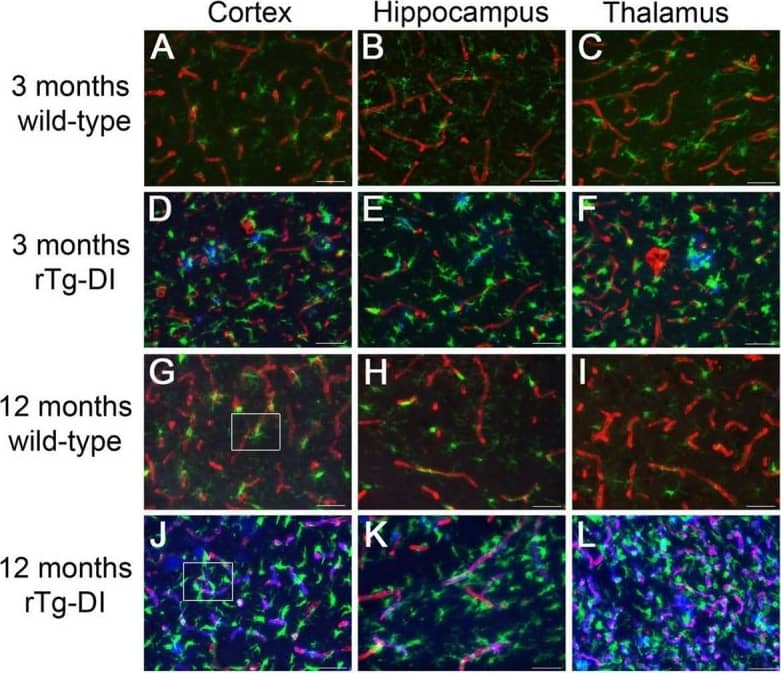 Immunocytochemistry/ Immunofluorescence: AIF-1/Iba1 Antibody [NB100-1028] - Increased perivascular microglia in rTg-DI rats. a–l Brain sections from 3-month-old wild-type (a–c) & rTg-DI (d–f) rats & 12-month wild-type (g–i) & rTg-DI (j–l) rats were labeled with Amylo-Glo to detect fibrillar amyloid (blue), rabbit polyclonal antibody to collagen IV to detect cerebral microvessels (red), & goat polyclonal antibody to Iba-1 to identify microglia (green). Scale bars = 50 μm. m, n Enlarged images of the highlighted regions of panels g & j, respectively. Scale bars = 10 μm. o Quantitation of microglia numbers from wild-type rats (black bars) & rTg-DI rats (gray bars) in different brain regions at 3 & 12 months of age. Data shown are mean ± SD of n = 5–6 rats per group. Compared to wild-type rats the microglia numbers were markedly elevated in rTg-DI rats & increased from 3 to 12 months of age in the measured brain regions. *P < 0.02, **P < 0.01, ***P < 0.001 Image collected & cropped by CiteAb from the following publication (//pubmed.ncbi.nlm.nih.gov/32127016), licensed under a CC-BY license. Not internally tested by Novus Biologicals.