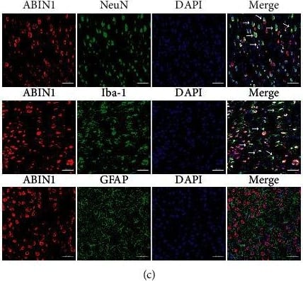 Immunocytochemistry/ Immunofluorescence: AIF-1/Iba1 Antibody [NB100-1028] - ABIN1 is colocated with A20 & NeuN & Iba-1, respectively, in the peri-infarct cortex. (a) Double immunofluorescence staining for ABIN1 & A20 in the peri-infarct cortex at 24 h after reperfusion (n = 3 rats per group). Scale bar = 50 μm. (b) Coimmunoprecipitation of ABIN1 & A20 in the peri-infarct cortex at 24 h after reperfusion (n = 3 rats per group). (c) Double immunofluorescence labeling of ABIN1 (red) & NeuN (green, neurons), Iba-1 (green, microglia), & GFAP (green, astrocytes), respectively (n = 3 rats per group). White arrows show that ABIN1 is colocalized with NeuN & Iba-1, respectively. Scale bar = 50 μm. (d) Comparisons of the percentage of ABIN1+ NeuN+ cells among ABIN1+ cells & ABIN1+ Iba-1+ cells among ABIN1+ cells in the peri-infarct cortex. ∗∗P < 0.01 compared to ABIN1+ NeuN+/ABIN1+. Image collected & cropped by CiteAb from the following publication (//pubmed.ncbi.nlm.nih.gov/33110436), licensed under a CC-BY license. Not internally tested by Novus Biologicals.