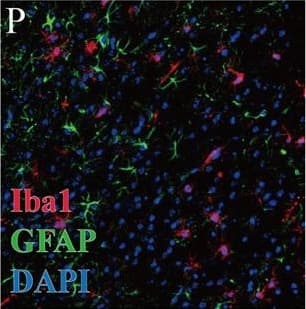 Immunocytochemistry/ Immunofluorescence: AIF-1/Iba1 Antibody [NB100-1028] - Representative & quantitative immunohistochemistry of the peri-infarct cortex before the bregma (coordinate + 0.58) in normal WT, normal sEH KO, MCAO WT, MCAO sEH KO, MCAO with vehicle treatment & MCAO with AUDA treatment mice (n = 2 for normal groups, n = 5–6 for all groups subjected to MCAO). (A–F, S) The number of CD31-positive endothelial cells significantly increased in the sEH KO before & after MCAO & post-MCAO AUDA-treated mice, while (G–L) Note the increased phosphorylated TrkB (p-TrkB) immunoreactivity that partially co-localized with NeuN-positive neurons, particularly in the sEH KO & AUDA-treated mice (arrows) (T). The percentage of NeuN- & p-TrkB-positive double labeling in the neuronal population was significantly increased compared to that in the corresponding controls. (M–R, U–V) GFAP-positive astrogliosis & Iba1-positive microglial infiltration decreased in post-MCAO sEH KO & AUDA treatment groups relative to that in the corresponding controls. The scale bar represents 50 µm. *p < 0.05, **p < 0.01, ***p < 0.001. Image collected & cropped by CiteAb from the following publication (//pubmed.ncbi.nlm.nih.gov/29311641), licensed under a CC-BY license. Not internally tested by Novus Biologicals.