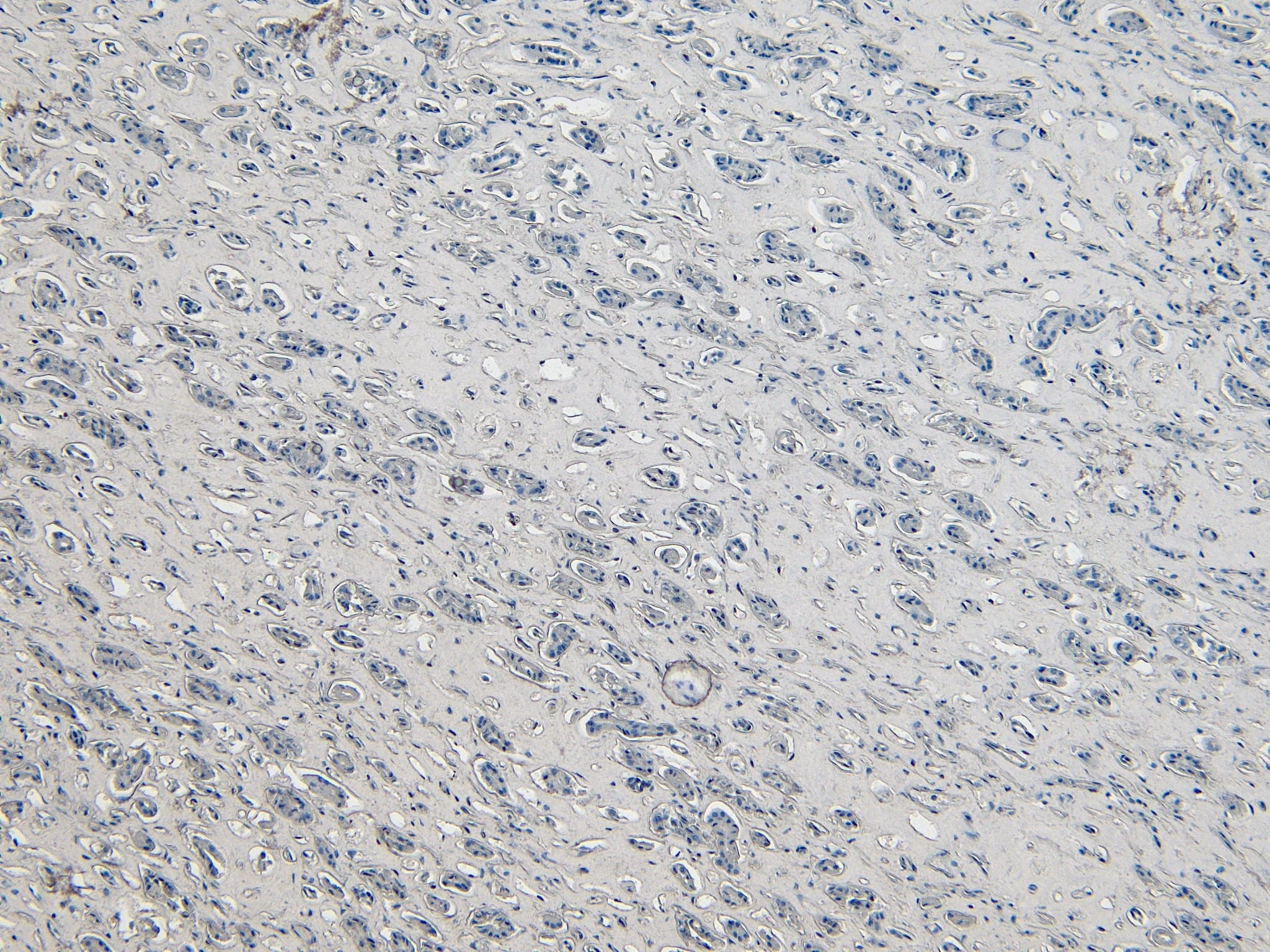 Immunohistochemistry-Paraffin: DAP3 Antibody [NB100-1032] - Negative Control showing staining of paraffin embedded Human Kidney, with no primary antibody.