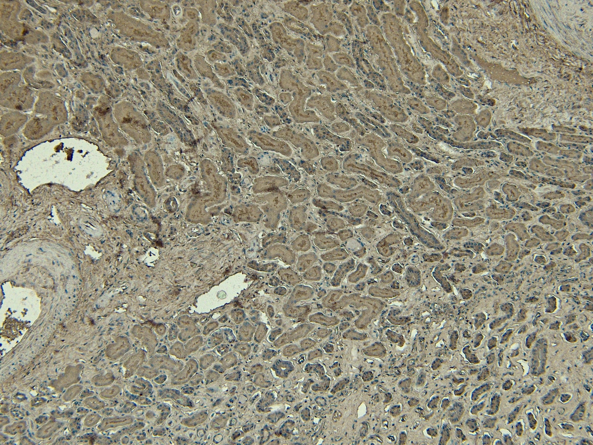 Immunohistochemistry-Paraffin: DAP3 Antibody [NB100-1032] - (5ug/ml) staining of paraffin embedded Human Kidney. Heat induced antigen retrieval with citrate buffer pH 6, HRP-staining.