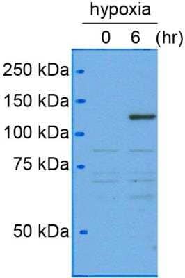 Western Blot HIF-1 alpha Antibody (H1alpha67)
