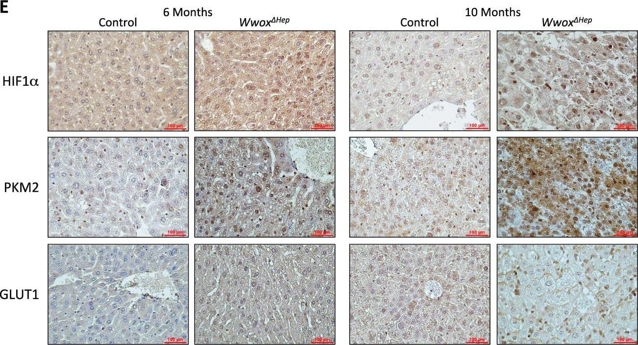 Immunohistochemistry-Paraffin HIF-1 alpha Antibody (H1alpha67)