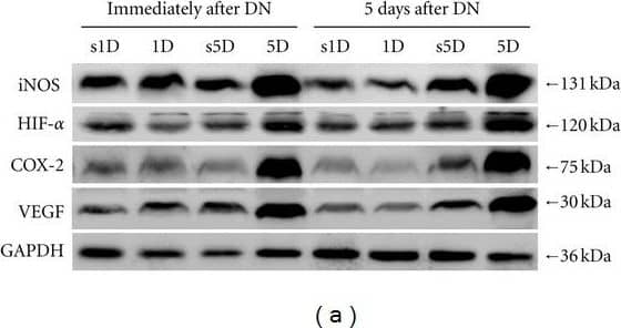 Western Blot HIF-1 alpha Antibody (H1alpha67)