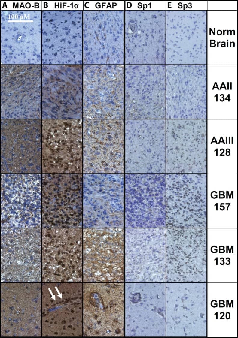 Immunohistochemistry HIF-1 alpha Antibody (H1alpha67)