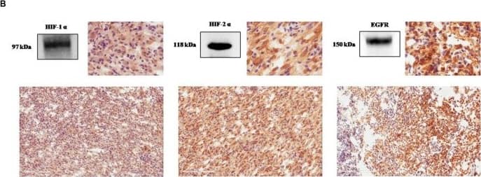 Western Blot HIF-1 alpha Antibody (H1alpha67)